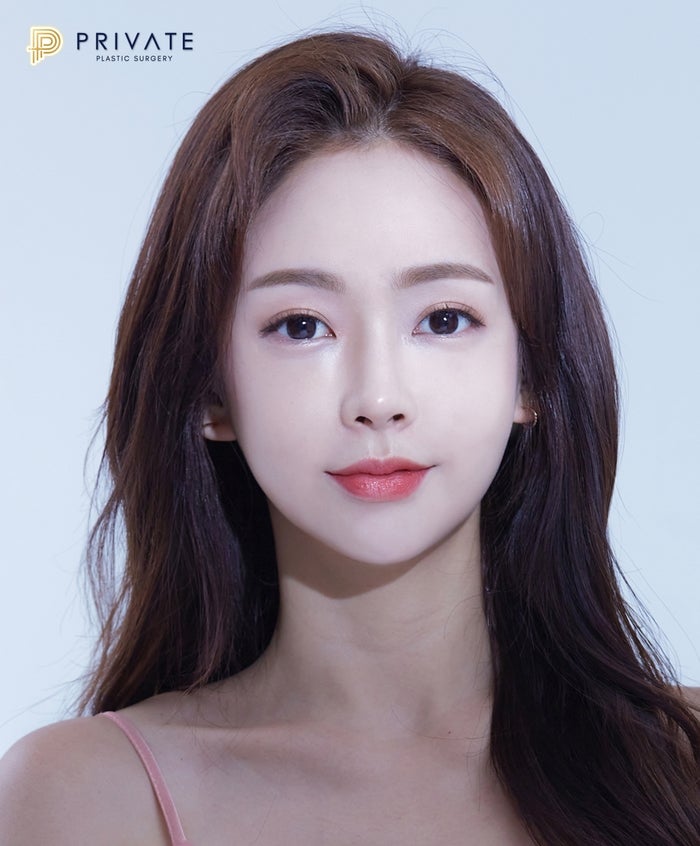 얼굴지방이식잘하는곳 프라이빗성형외과에서 생기찾기 사진 3