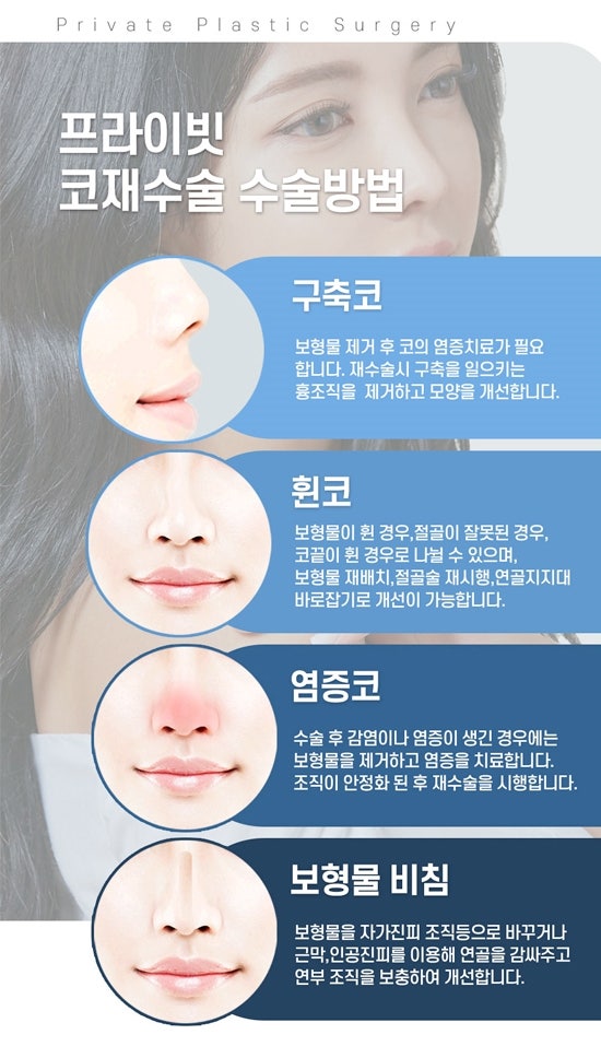 짧은코재수술 하고 원하는 느낌 찾자 사진 5
