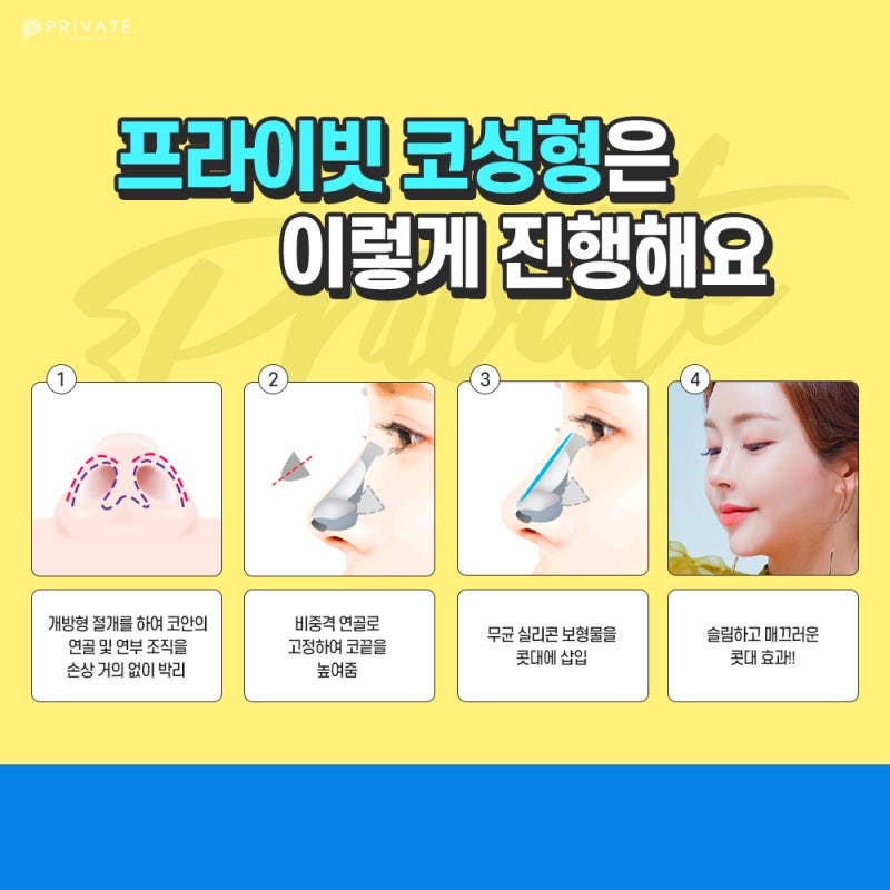 세련된 코라인 어디로 알아보면 좋을까 사진 4