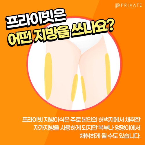 얼굴지방이식 프라이빗성형외과 에서 꼼꼼히 체크해보세요 사진 7