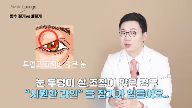프라이빗성형외과 비절개쌍수VS절개쌍수 어떤게 좋을까?