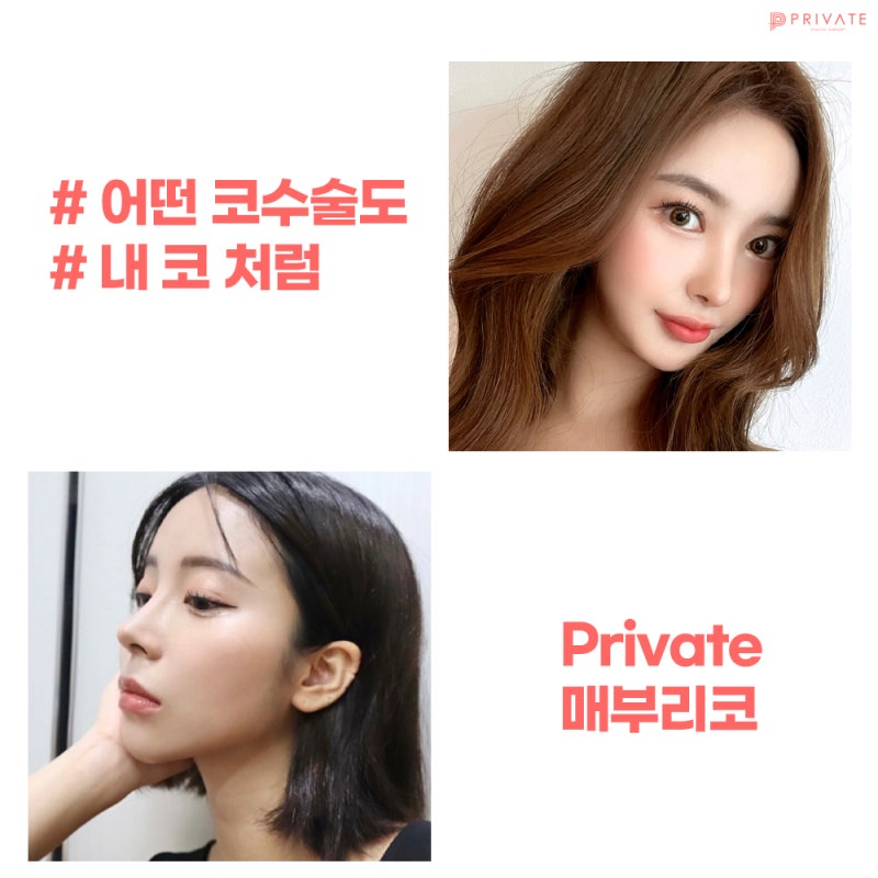 신사매부리코성형잘하는병원 알아보기 사진 5