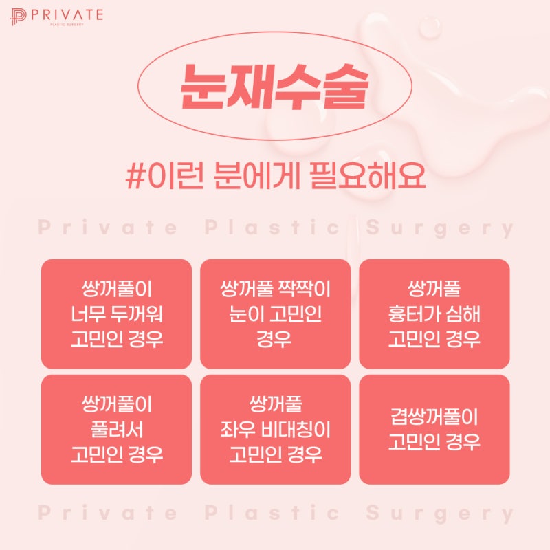 눈재수술유명한곳 프라이빗성형외과 사진 5