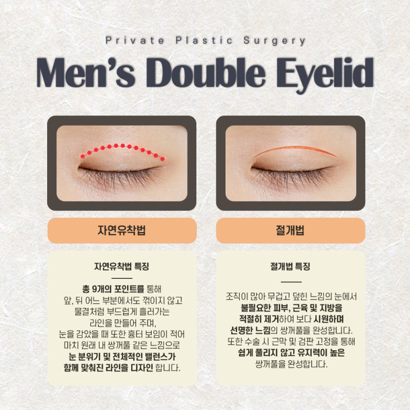 남자눈성형수술 인상을고려하여 자연스럽게, 프라이빗성형외과 사진 4