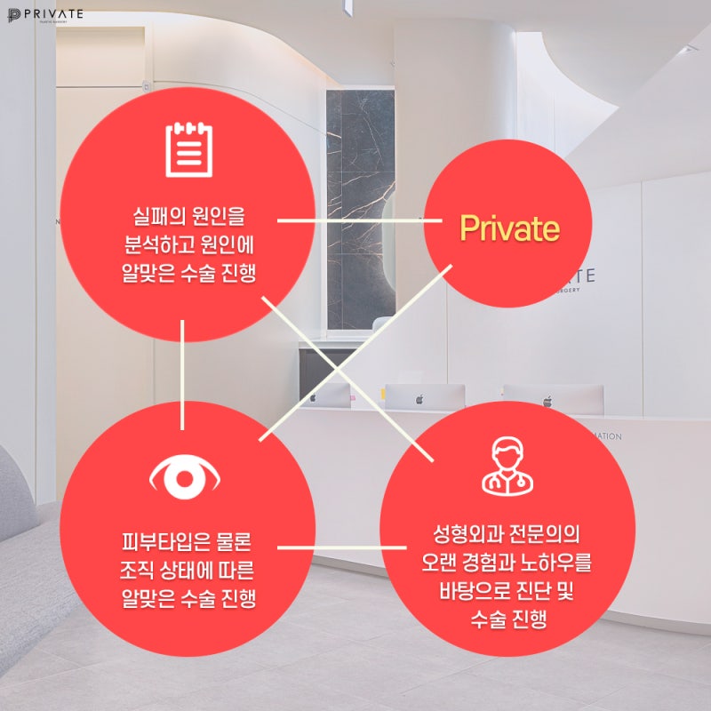 프라이빗성형외과트임성형으로 눈매를 시원하게 사진 5