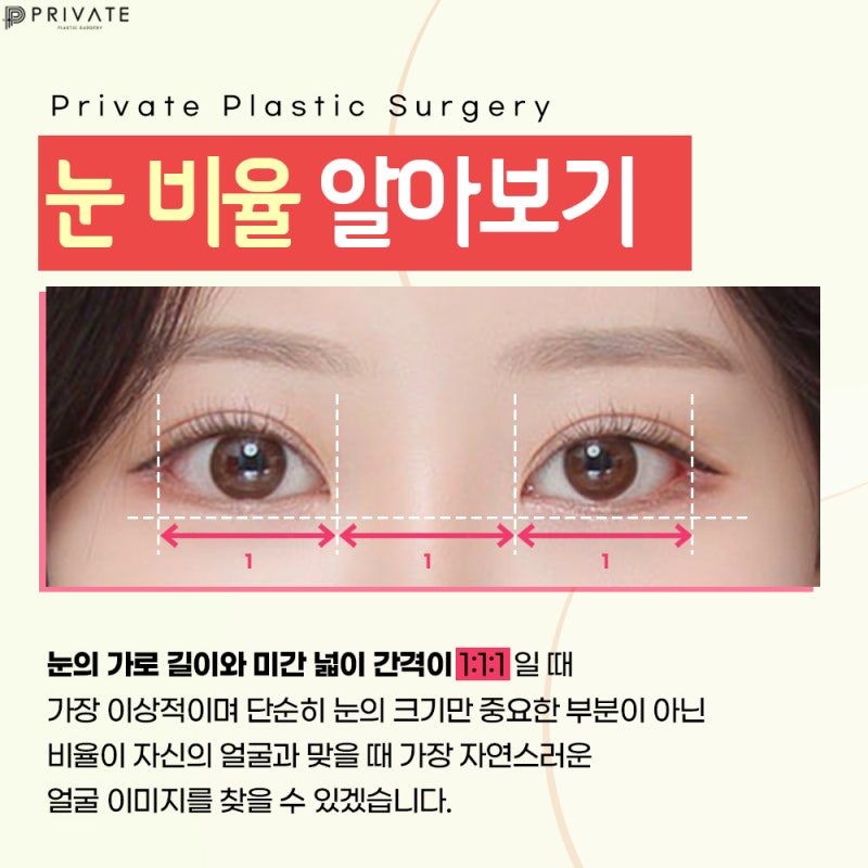 프라이빗성형외과트임성형으로 눈매를 시원하게 사진 3