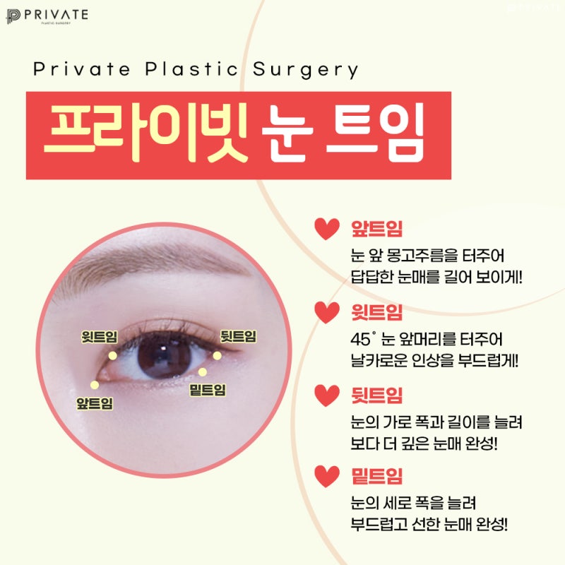 프라이빗성형외과트임성형으로 눈매를 시원하게 사진 4