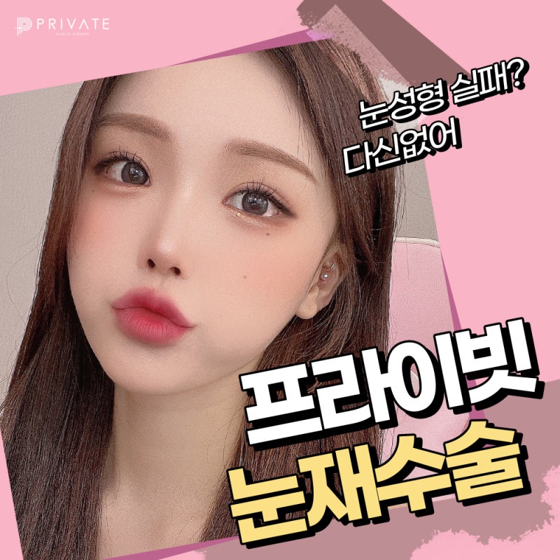 눈재수술유명한곳 프라이빗성형외과! 사진 2