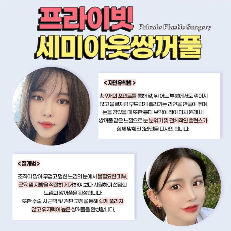 세미아웃라인쌍수라인예쁜곳 프라이빗성형외과 사진 4