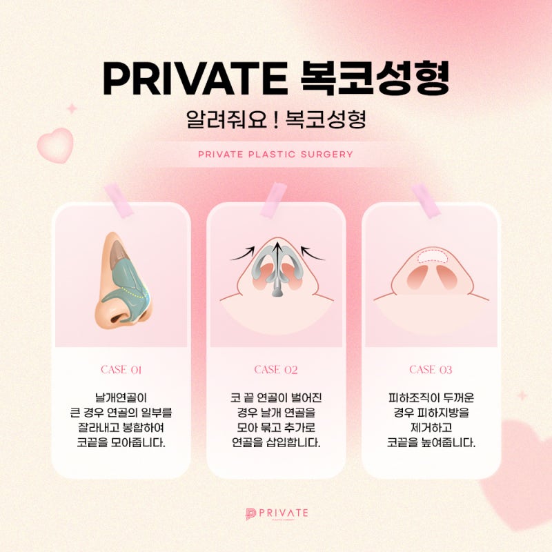 복코성형수술은 프라이빗성형외과 사진 5