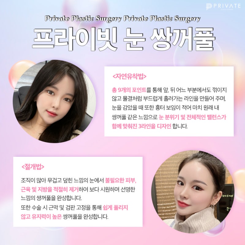 쌍꺼풀수술눈성형은 프라이빗성형외과 사진 4