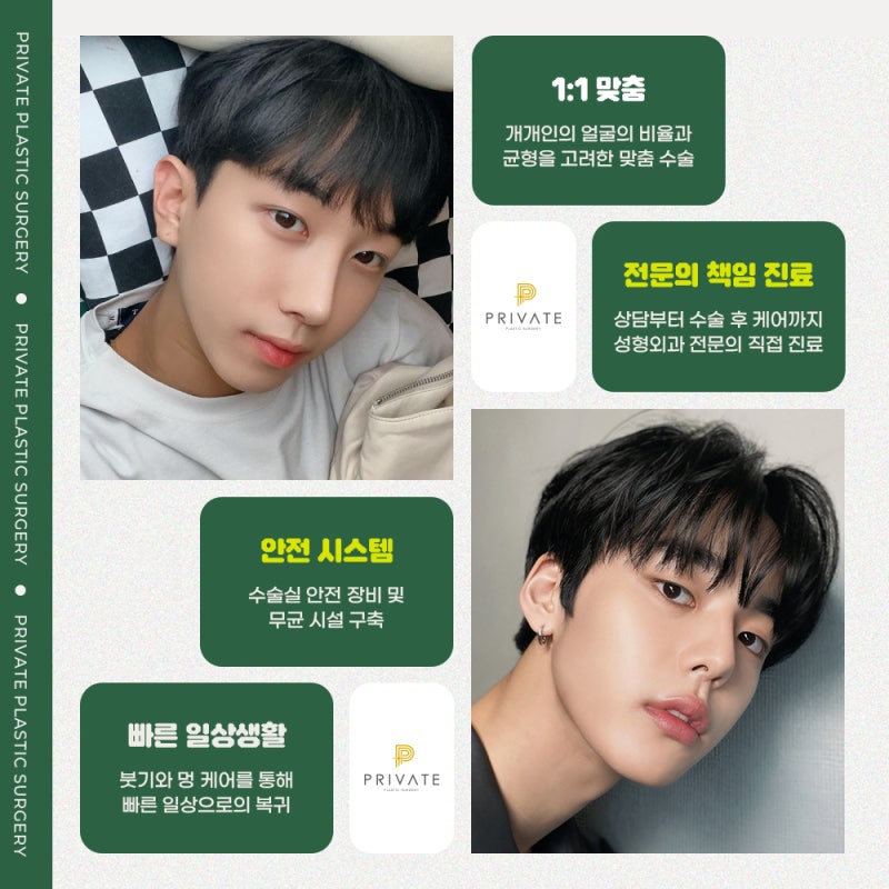 남자눈성형수술후기는 프라이빗성형외과 사진 4
