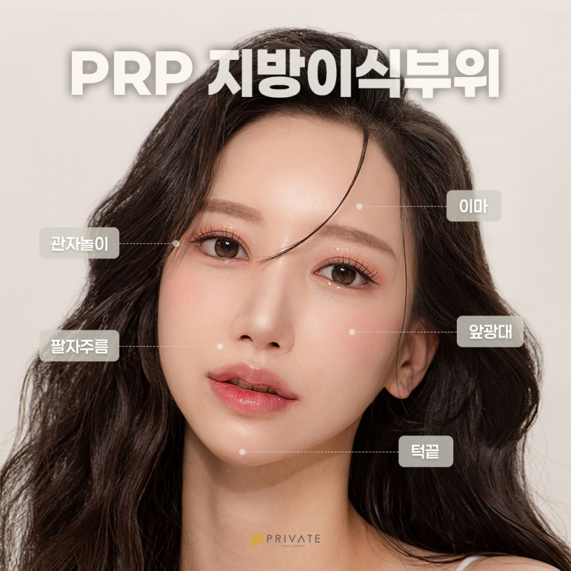 PRP지방이식으로 볼륨감 있는 얼굴, 프라이빗성형외과 사진 4