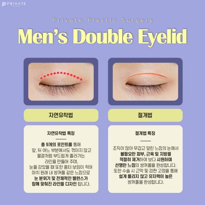 남자 쌍꺼풀 깔끔한 곳, 프라이빗성형외과 사진 5