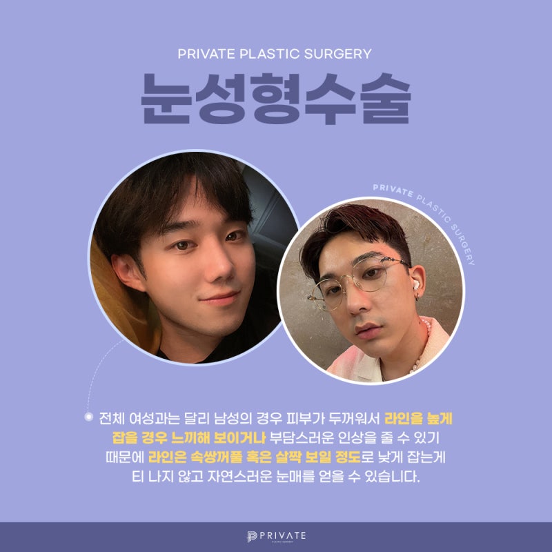 남자 쌍꺼풀 깔끔한 곳, 프라이빗성형외과 사진 4