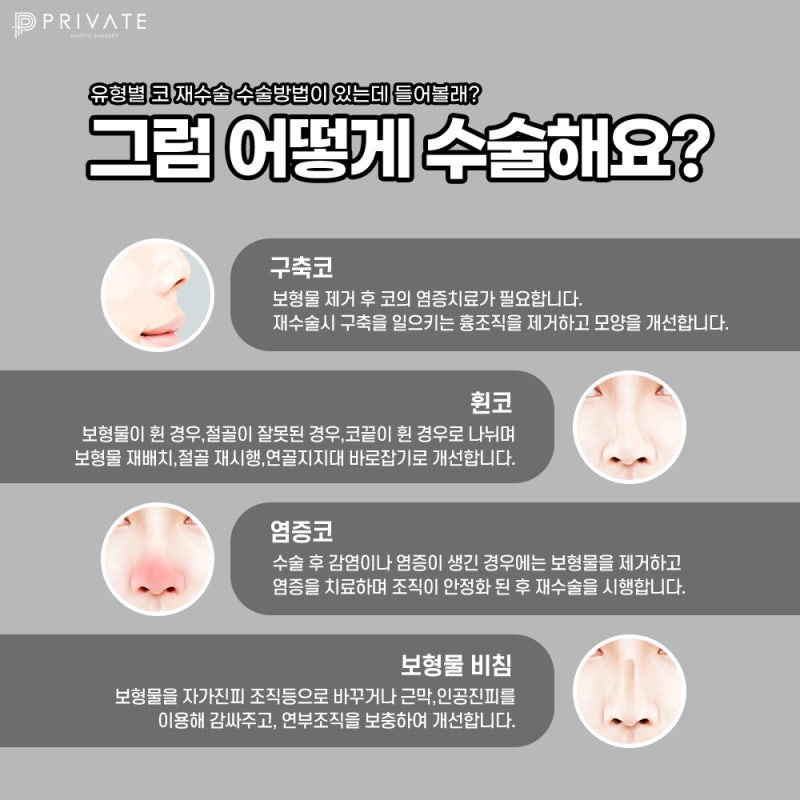 신사역 코재수술 잘하는곳 프라이빗성형외과 사진 4