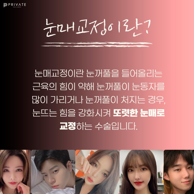 눈매교정 또렷하게 잘하는곳 프라이빗성형외과