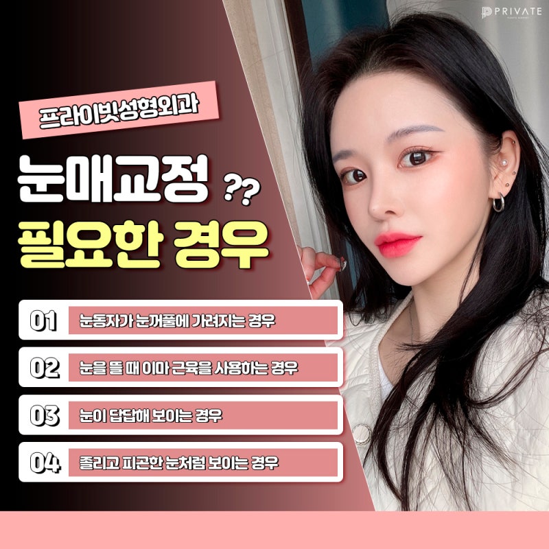 눈매교정 또렷하게 잘하는곳 프라이빗성형외과 사진 4