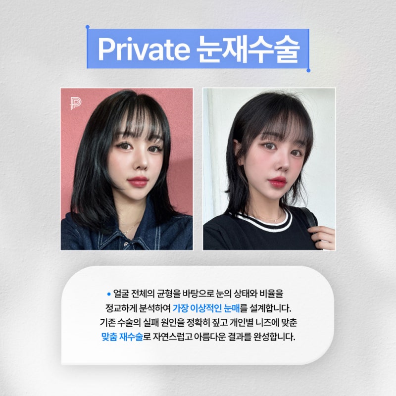 프라이빗성형외과 눈재수술잘하는곳