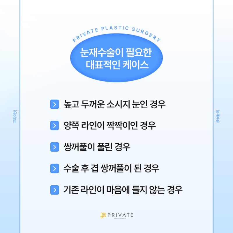 프라이빗성형외과 눈재수술잘하는곳 사진 5