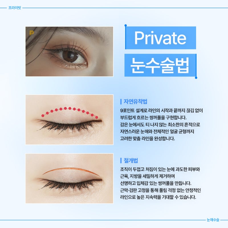 프라이빗성형외과 눈재수술잘하는곳 사진 4