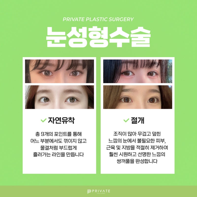 신사 프라이빗성형외과 눈성형수술 유명한곳 사진 4
