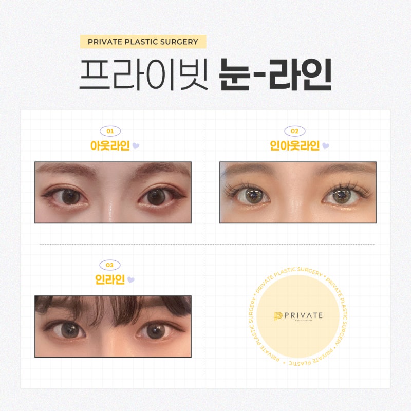 눈재수술성형은 신중하게, 프라이빗성형외과