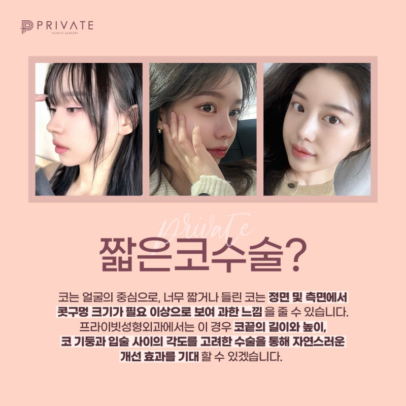 짧은코수술 잘하는병원 프라이빗성형외과 사진 3