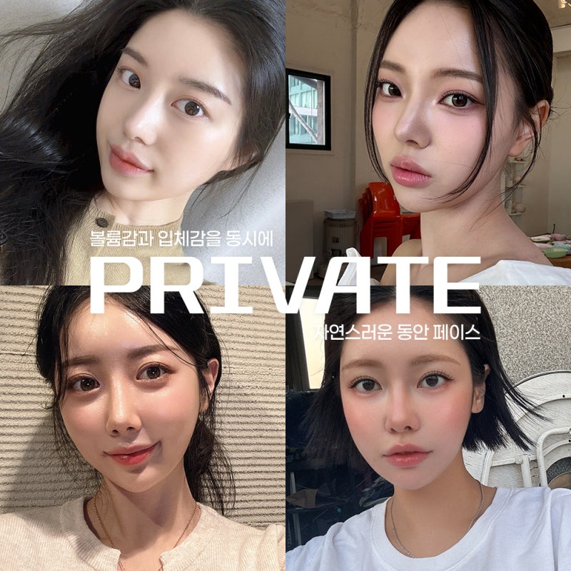 풀페이스지방이식 자연스럽게, 프라이빗성형외과 사진 6
