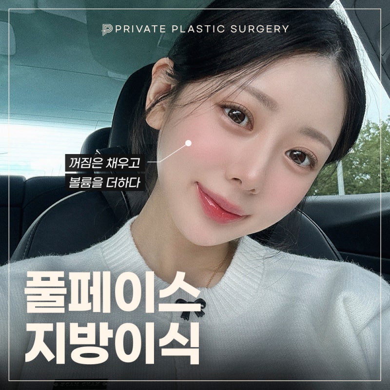 풀페이스지방이식 자연스럽게, 프라이빗성형외과 사진 2