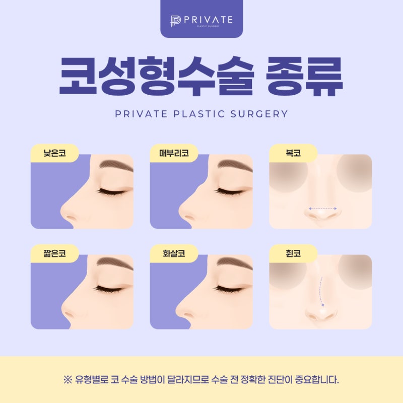 코성형수술잘하는곳은 신사프라이빗성형외과