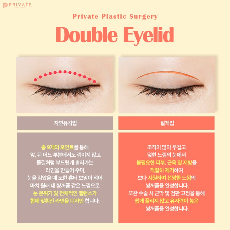 눈재수술성형 후기좋은곳 프라이빗성형외과 사진 3