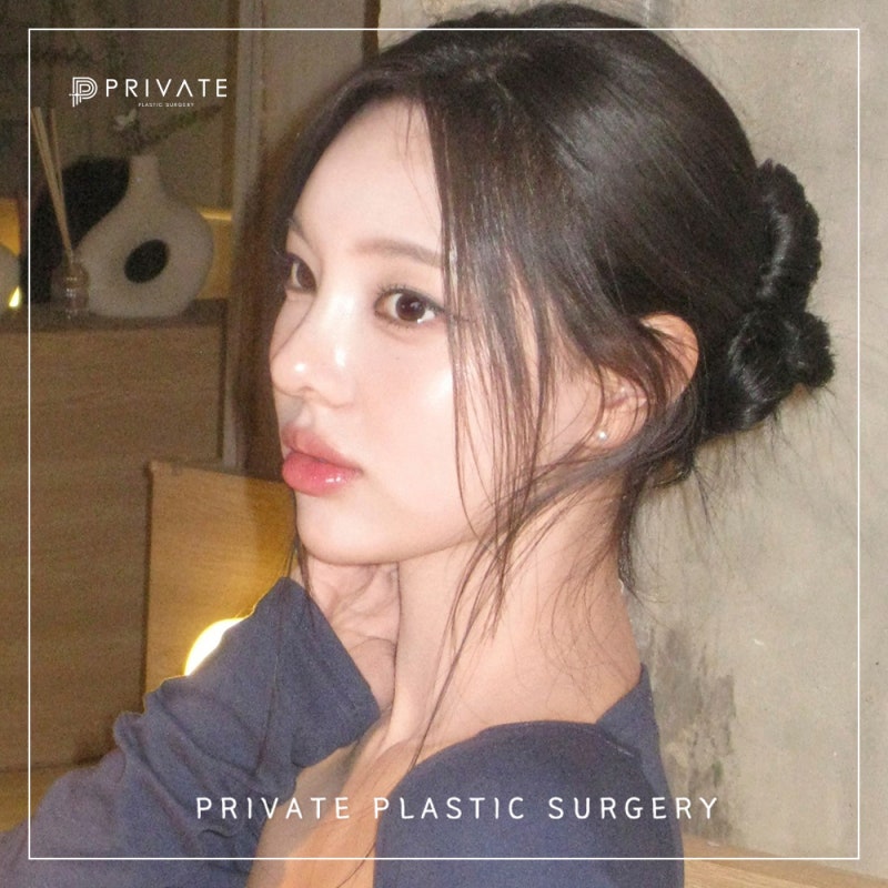 성형리얼모델상시모집 프라이빗성형외과 사진 5