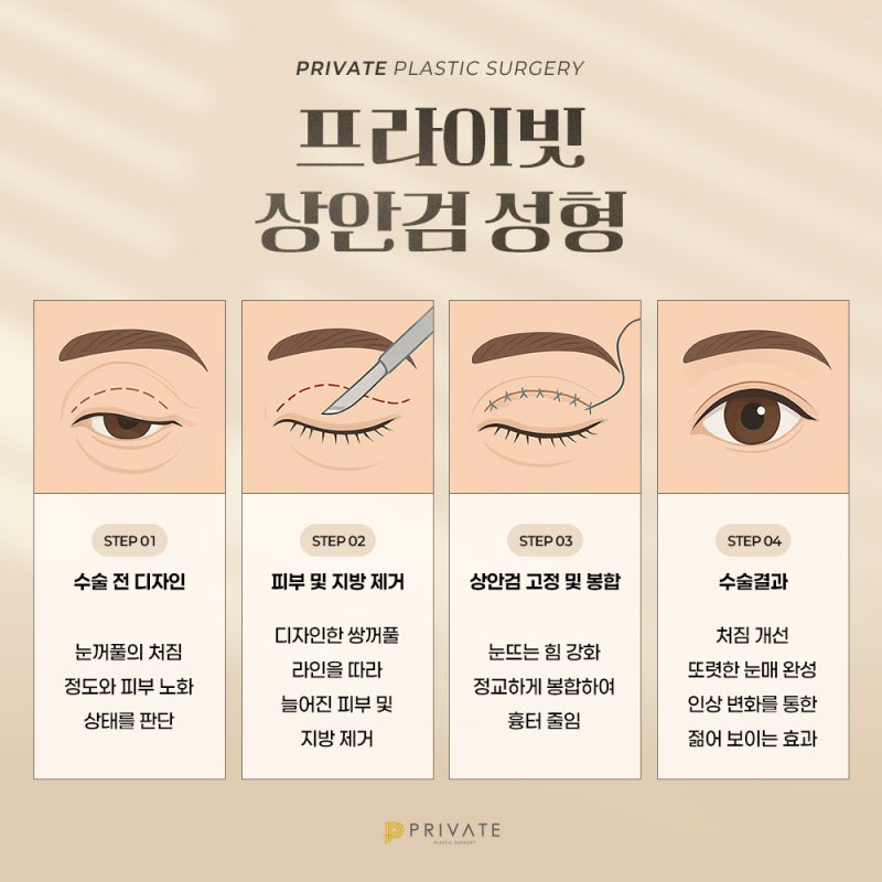 상안검성형 중년성형후기좋은곳 프라이빗성형외과 사진 5