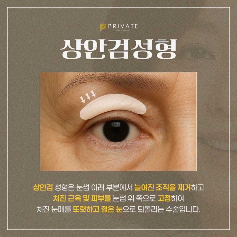 상안검성형 중년성형후기좋은곳 프라이빗성형외과