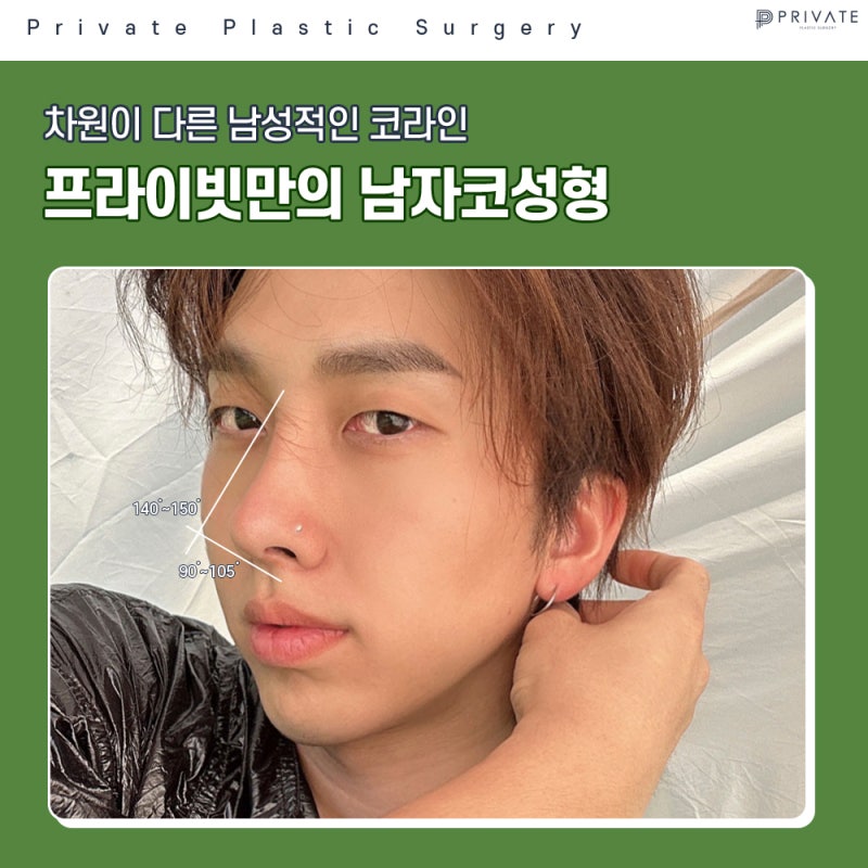 남자코성형수술 후기 많은곳 프라이빗성형외과 사진 5