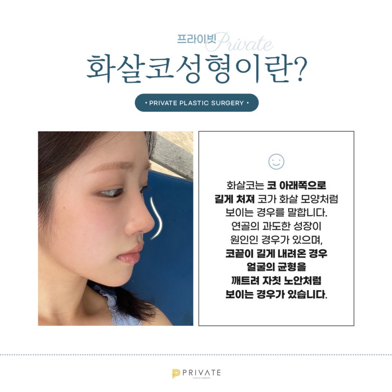 화살코성형, 자연스러운 코라인으로 프라이빗성형외과