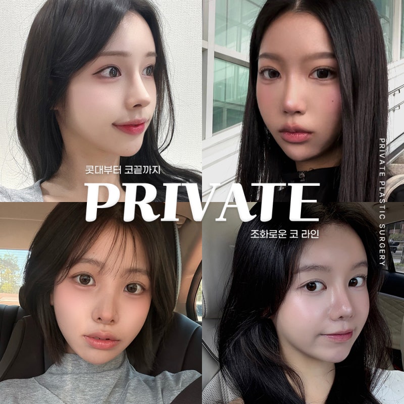 화살코성형, 자연스러운 코라인으로 프라이빗성형외과 사진 6