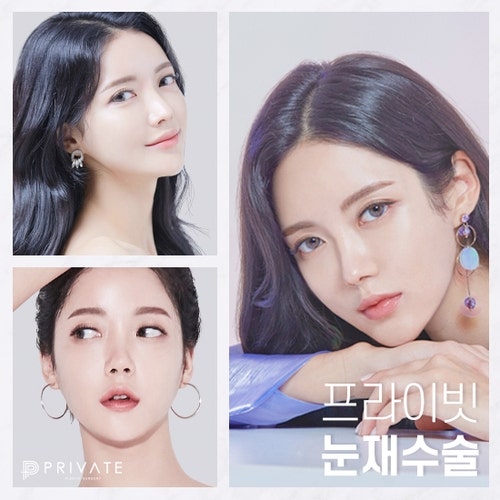 소세지눈 재수술 고민이라면 프라이빗성형외과 사진 2