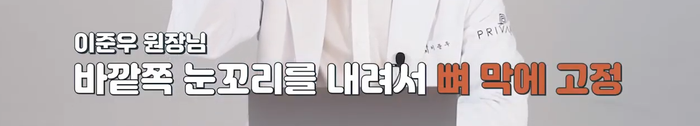 การผ่าตัดขยายหางตาและลดระดับหางตาที่ Private Plastic Surgery Clinic กับคุณหมออี จุน-อู 사진 11