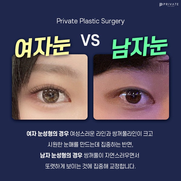 Tempat Terbaik untuk Operasi Koreksi Mata Pria adalah Private Plastic Surgery, #LeeJinHwa #DirekturLeeJunWoo 사진 4