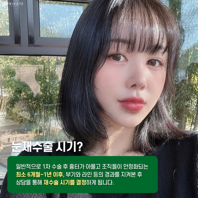 Tempat Terbaik untuk Operasi Mata Revisi: Private Plastic Surgery Clinic 사진 4