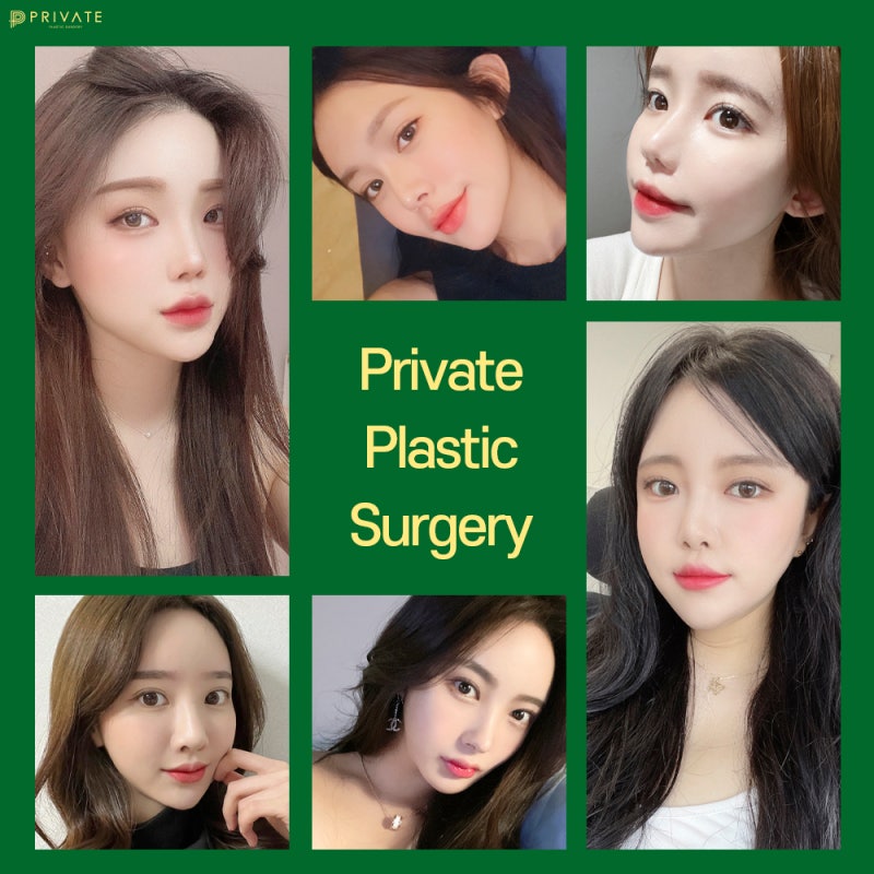 Tempat Terbaik untuk Operasi Mata Revisi: Private Plastic Surgery Clinic 사진 7