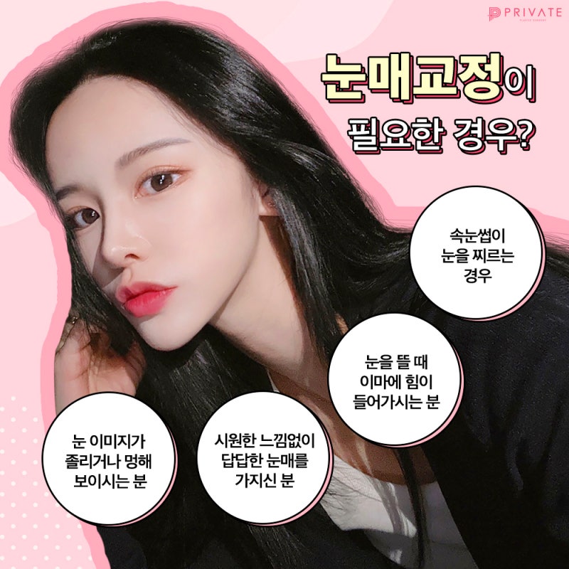 안검하수눈매교정은 프라이빗성형외과 사진 5