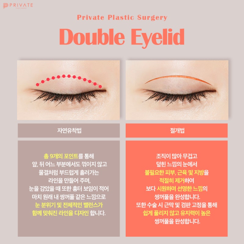Tempat Bedah Mata Revisi yang Bagus, Private Plastic Surgery feat. Perekrutan Model 사진 4