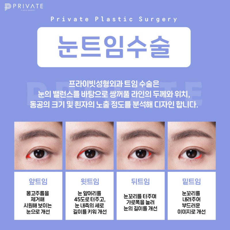 Tempat Terbaik untuk Operasi Transeksi Mata Belakang Bawah: Private Plastic Surgery Clinic