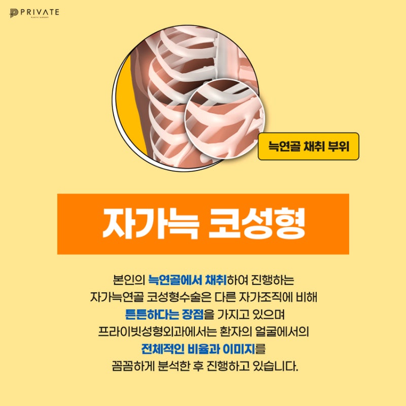 Operasi Rhinoplasty Tulang Rawan Rusuk Autologus di Private Plastic Surgery