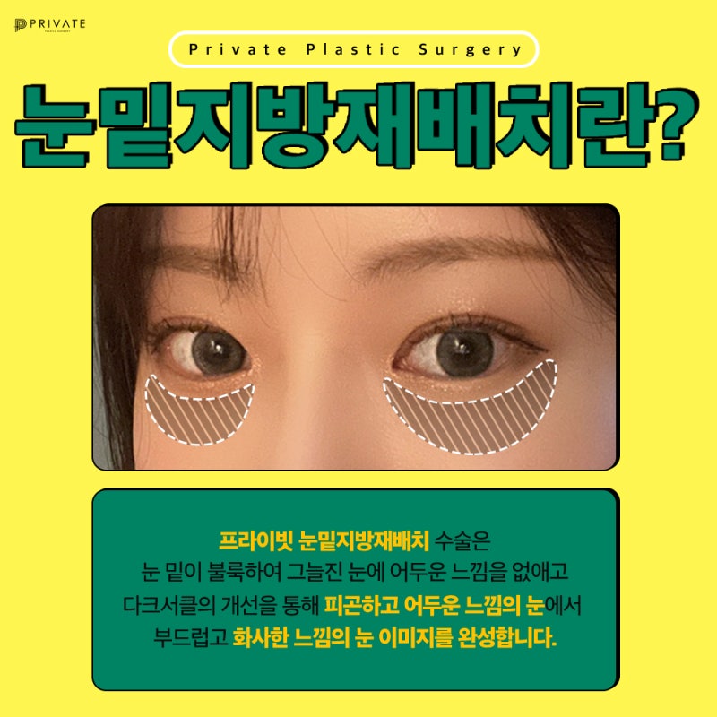 Mari Mengenal Prosedur Penataan Ulang Lemak Bawah Mata di Private Plastic Surgery 사진 3