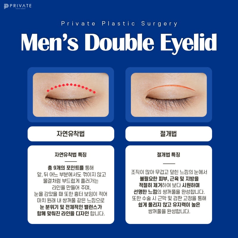 남자눈성형잘하는곳은 프라이빗성형외과 사진 3