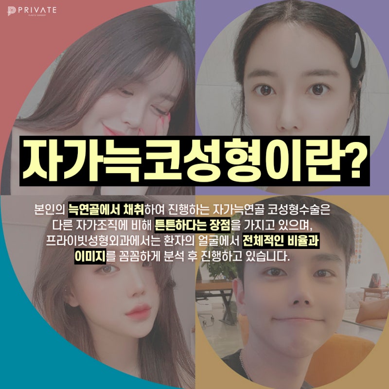 Operasi Rhinoplasty Tulang Rawan Rusuk Autologus di Private Plastic Surgery